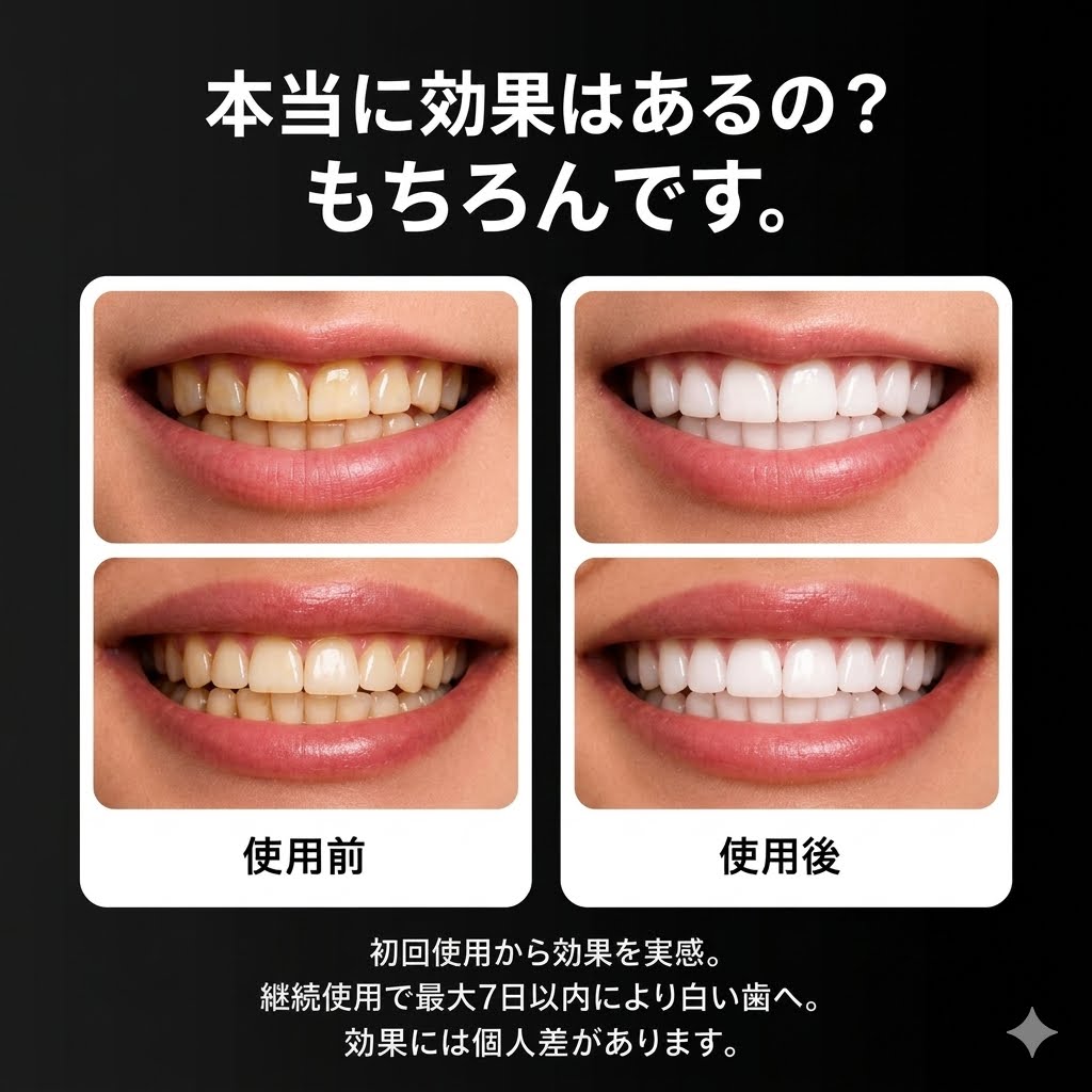 Ceelike ホワイトニングシート｜過酸化物不使用。 自宅で・やさしく・30分で