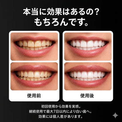 Ceelike ホワイトニングシート｜過酸化物不使用。 自宅で・やさしく・30分で